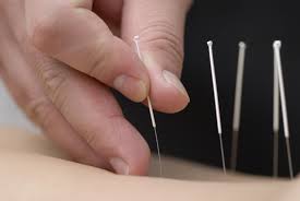 acupuncturist