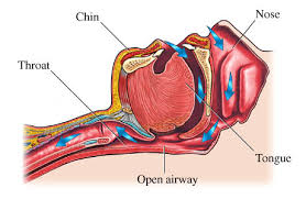 airway