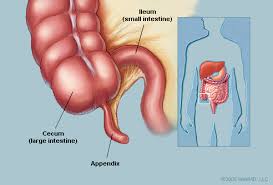 appendix