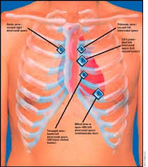 auscultation