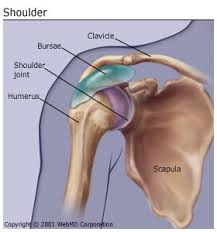 bursitis