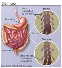 diarrhoea