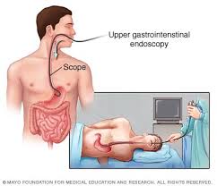 endoscopy