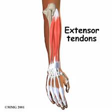 extensor