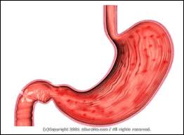 gastritis