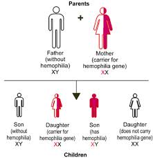 hemophilia