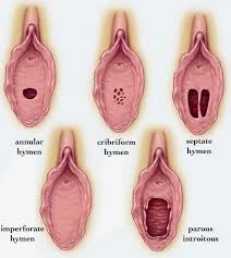 hymen