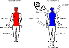 hypothermia