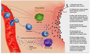 inflammation