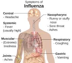 influenza