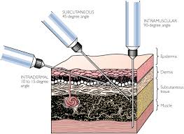 intramuscular