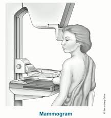 mammogram