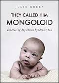 mongoloid