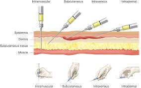 parenteral