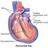 pericardium