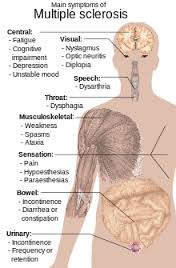 sclerosis